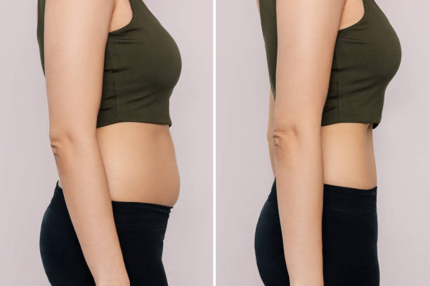 Two shots of a woman in profile with a belly with excess fat and toned slim stomach with abs before and after losing weight isolated on a beige background. Result of diet, liposuction, training