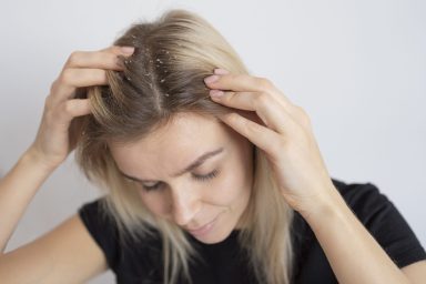 close-up-woman-with-dandruff