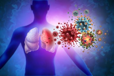 Triple Virus Lung Infection and Tripledemic Human lung infection and respiratory inflammation disease as influenza flu outbreak or pneumonia and pulmonary inflammatory illness with 3D illustration elements.